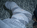 [Picture: My left Foot]