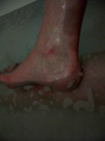 [picture: Wet ankle]