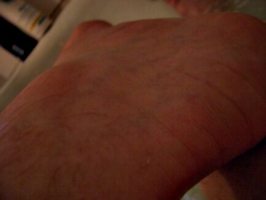 [picture: Ankle close-up]