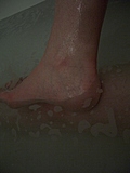 [Picture: Wet ankle]