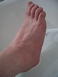 [Picture: A wet bare foot]
