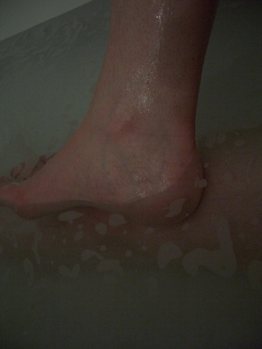 [Picture: Wet ankle]