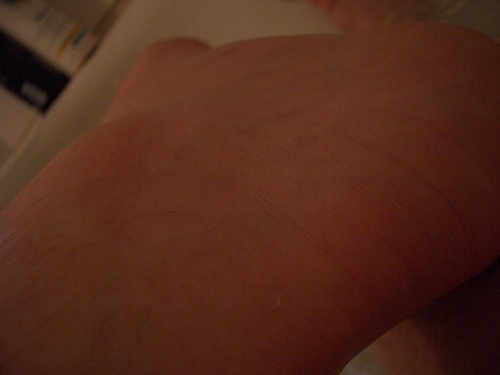 [Picture: Ankle close-up]