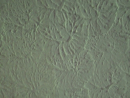 [picture: texture: plaster ceiling]