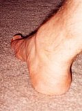 [Picture: My right foot.  Sounds like a film!]